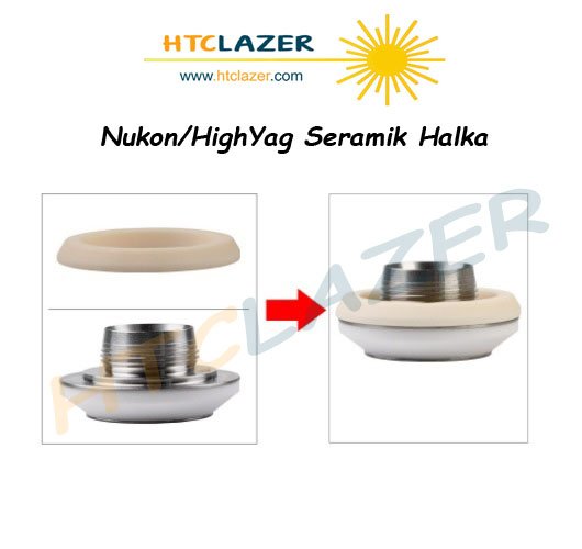 Nukon/HighYag Seramik Halka